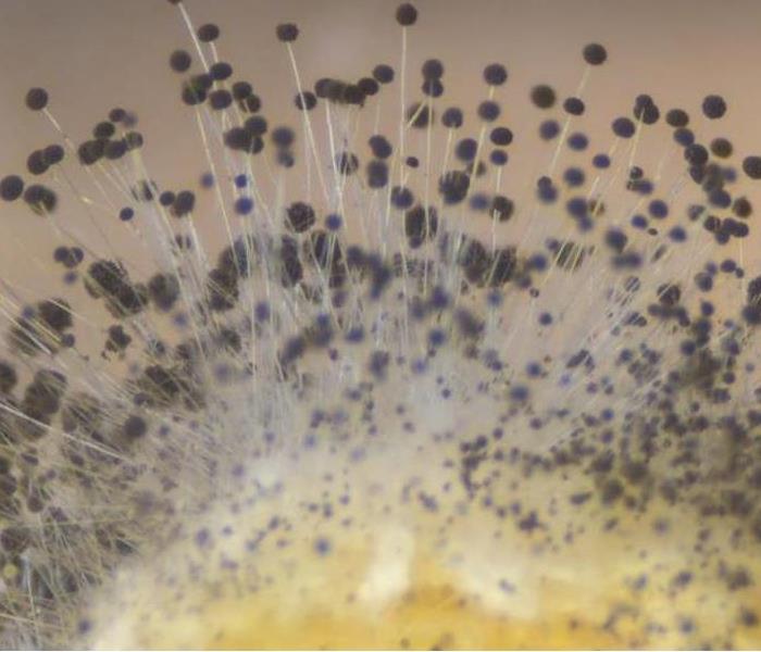 Mold Spores under a microscope
